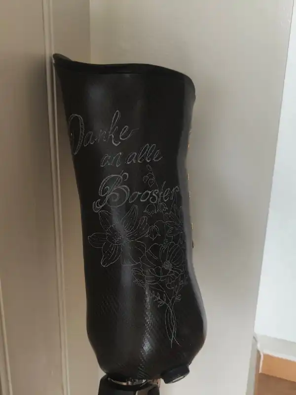 News 6: Die Prothese ist montiert – und es/sie läuft 