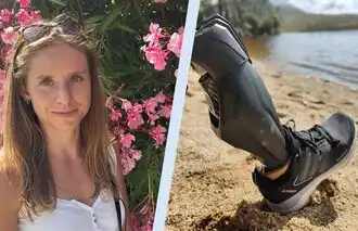 Beinprothese für Isabelle