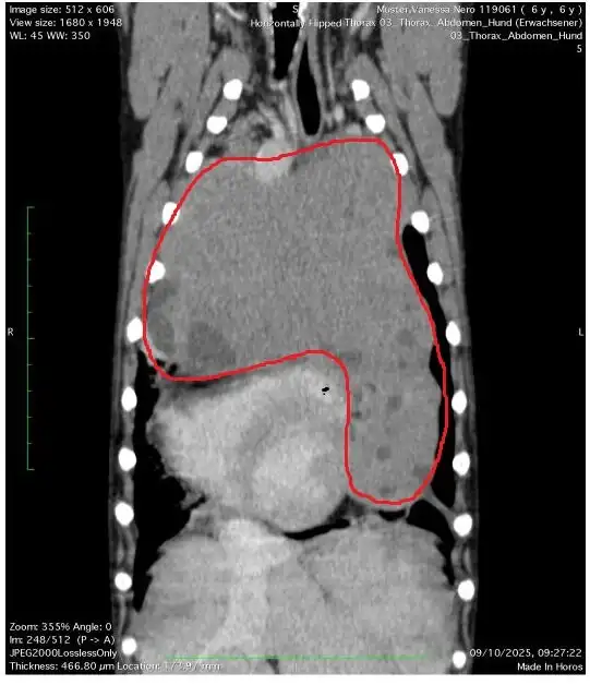 Tumoroperation für Nero