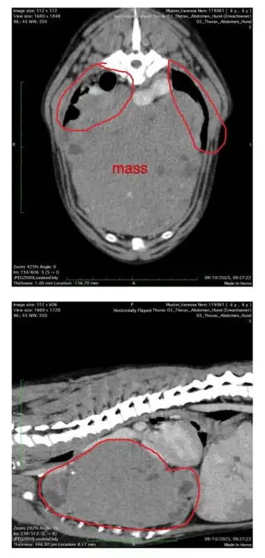 Tumoroperation für Nero